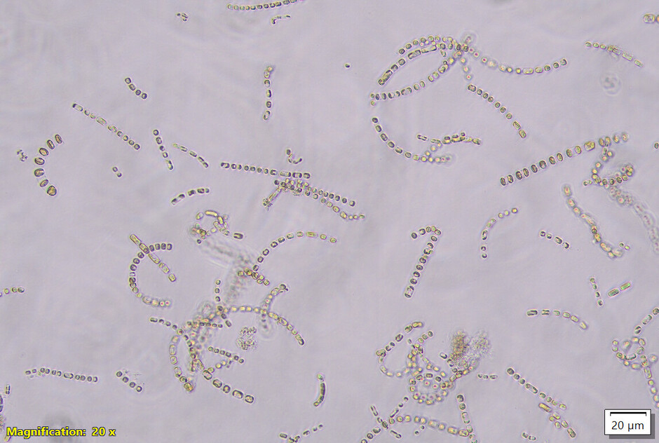 Mikroskopfoto av mikroalger